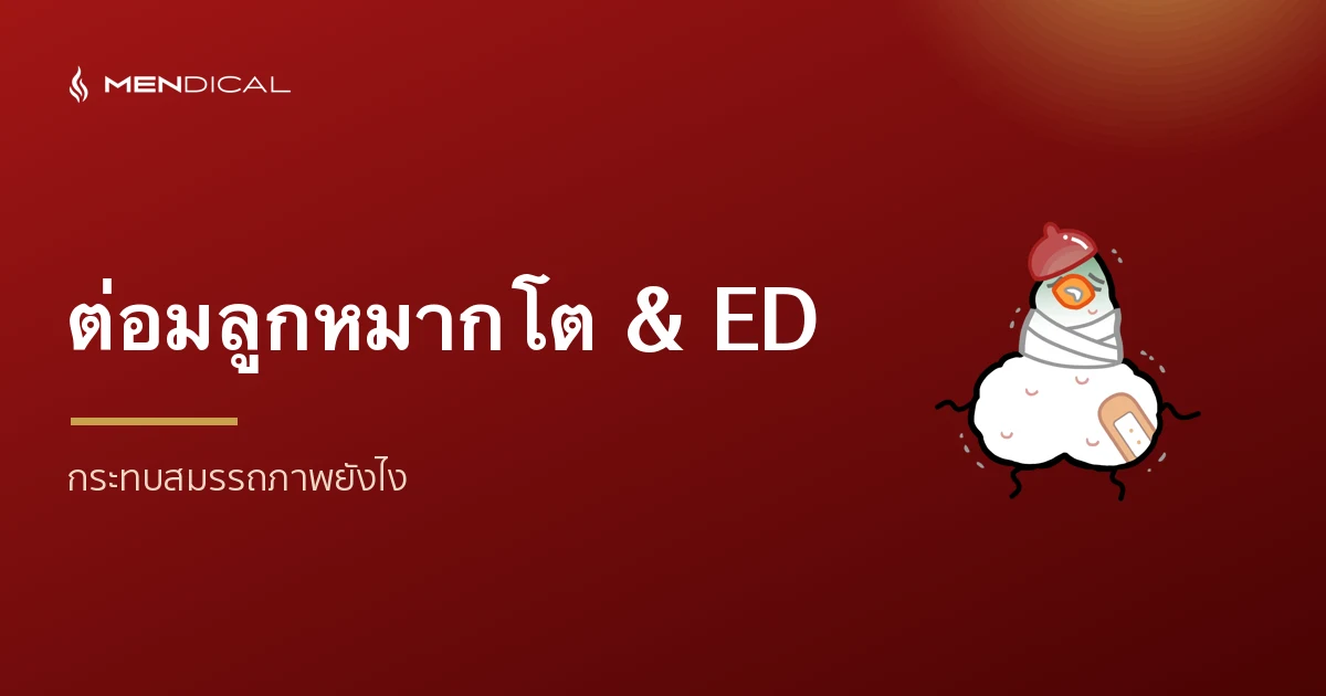 ต่อมลูกหมากโต ทำให้นกเขาไม่ขัน (ED) ไหม? ผลต่อสมรรถภาพและการหลั่ง