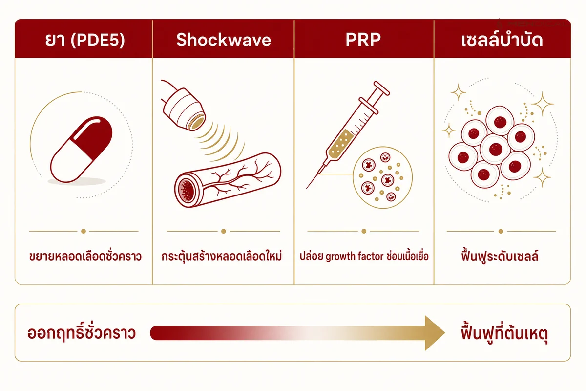 เทียบจุดออกฤทธิ์: ยาช่วยชั่วคราว ส่วน Shockwave / PRP / เซลล์บำบัด มุ่งฟื้นฟูเนื้อเยื่อและหลอดเลือดที่ต้นเหตุ