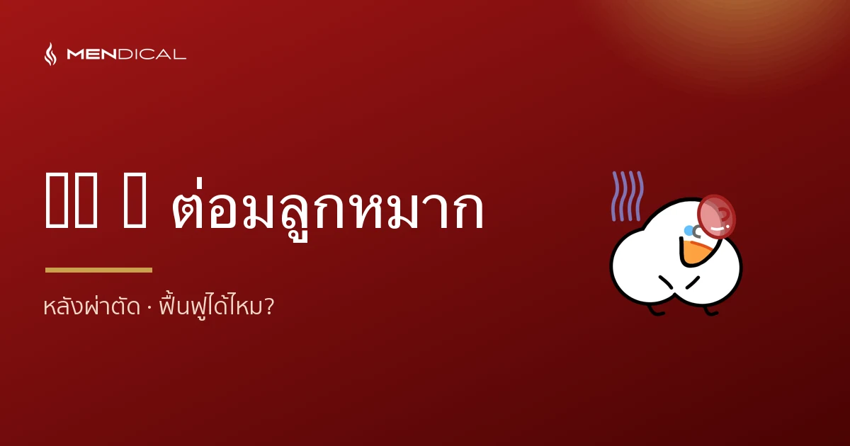 ED หลังผ่าตัดต่อมลูกหมาก เกิดจากอะไร และฟื้นฟูได้ไหม?