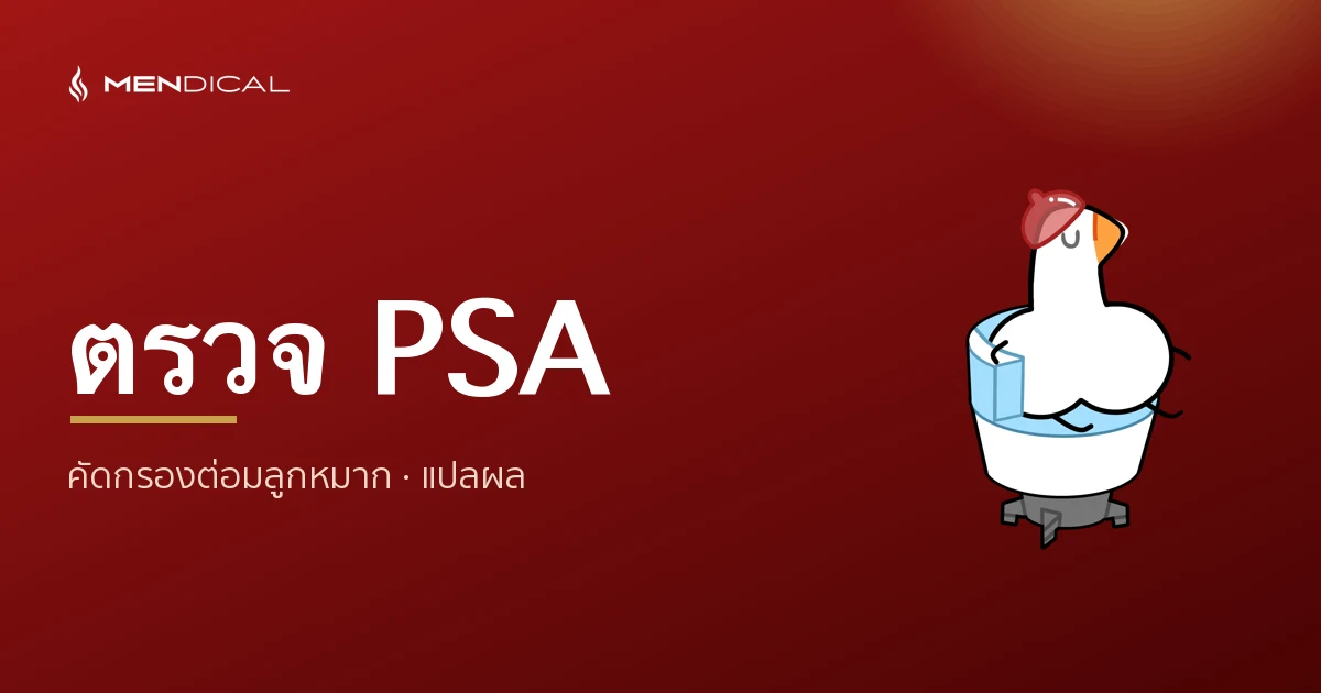 ตรวจ PSA คืออะไร? คัดกรองต่อมลูกหมาก ควรตรวจตอนไหน แปลผลอย่างไร